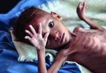 Malnutrition | Malnutrition Essay Malnutrition Essay