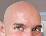 The Advantages of Bald Head The Advantages of Bald Head