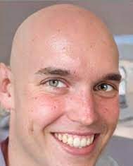 The Advantages of Bald Head The Advantages of Bald Head